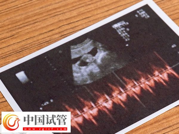 杭州正规促排医院排名公布，浙江省妇保医院综合第一(图1)