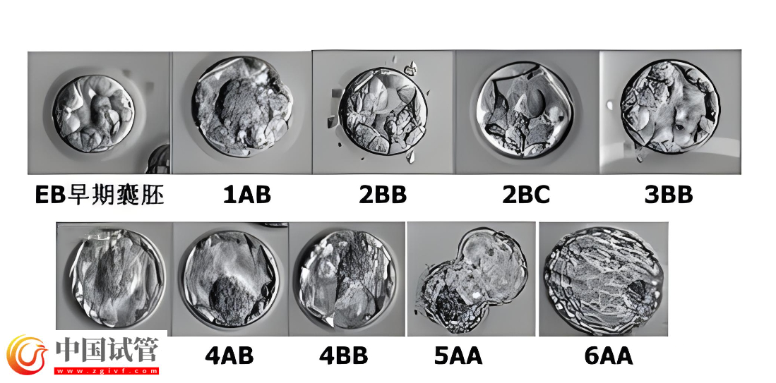 囊胚等级与宝宝健康之间有关系吗？(图3)