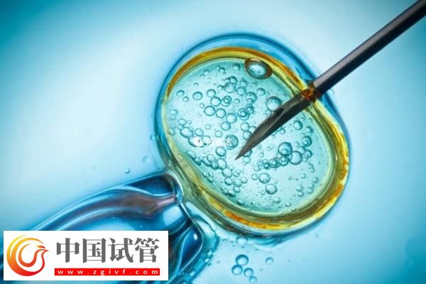 同性恋可不可以做试管婴儿生龙凤胎(图1)