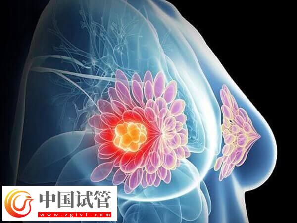 移植后乳房越来越软的原因是什么(图1)