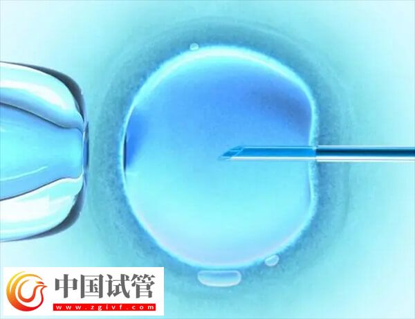 三代试管可不可以单精子注射(图1)