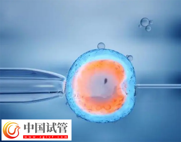 上海试管婴儿成功率(图1)