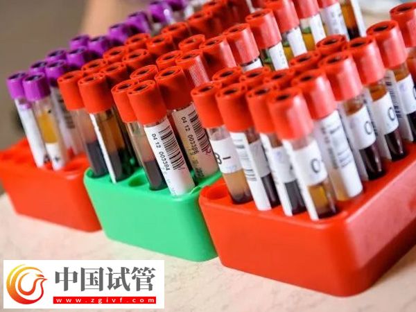 在东莞人民医院做试管成功率高不高(图2)
