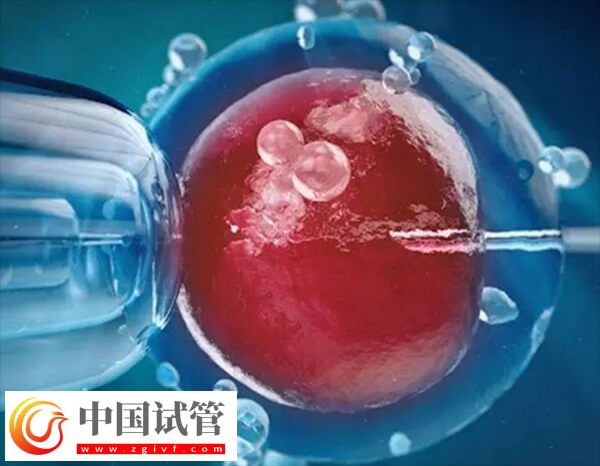 试管婴儿能否一次移植成功(图2)