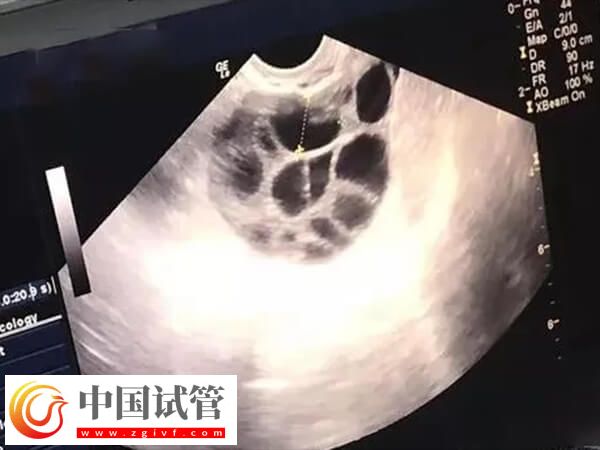 取卵18个能配多少胚胎(图2)