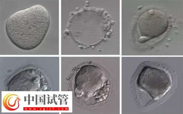 女性内膜13b是否可以移植囊胚胚胎(图3)