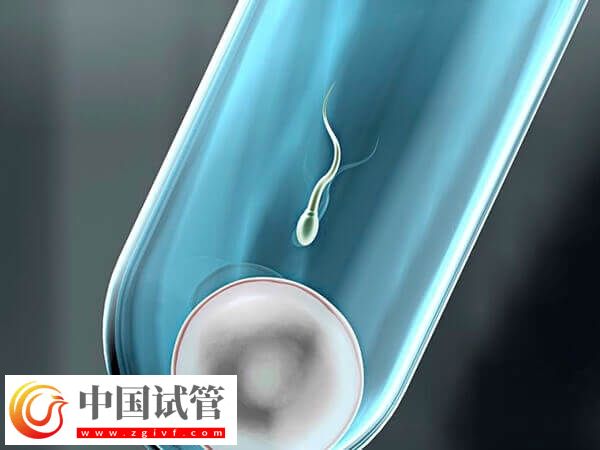 什么会影响试管婴儿成功率(图2)