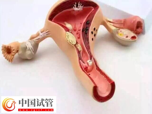 什么会影响试管婴儿成功率(图1)