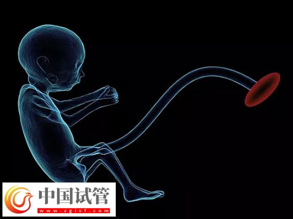 试管出生双胞胎的健康与什么有关(图1)
