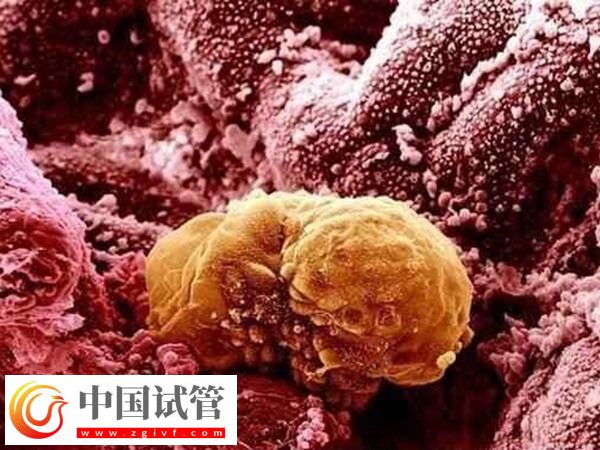 卵巢早衰amh值0.08试管能不能成功(图1)