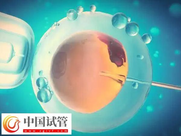 身高153做试管能不能要双胞胎(图1)
