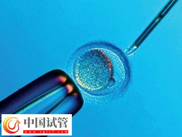身高153做试管能不能要双胞胎(图2)