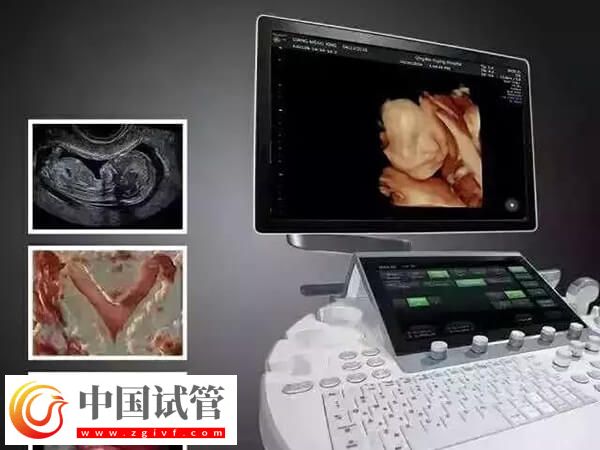 鹰潭公立三甲医院做一次四维彩超多少钱？(图1)
