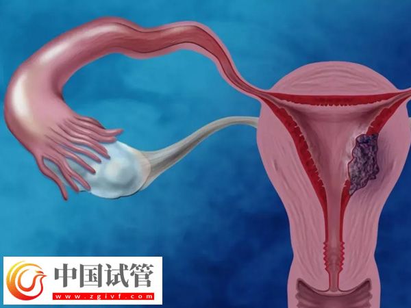 攀枝花试管医院哪家好(图2)