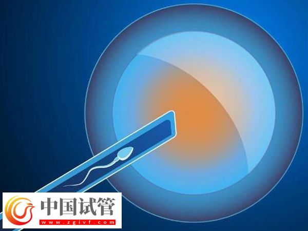 攀枝花试管医院哪家好(图1)