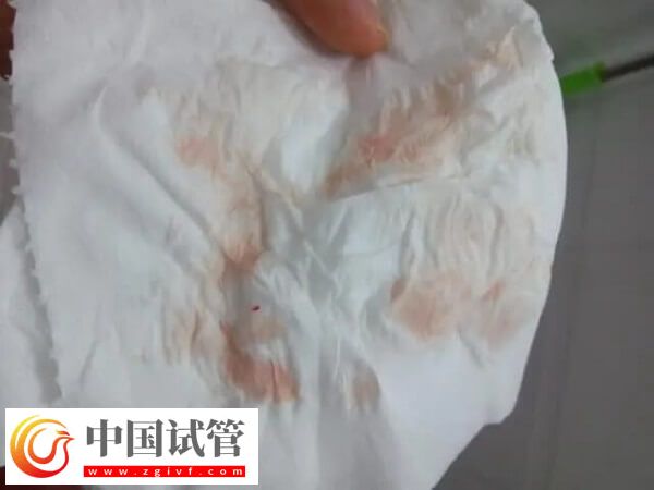 胚胎移植后大便不成形怎么回事(图2)