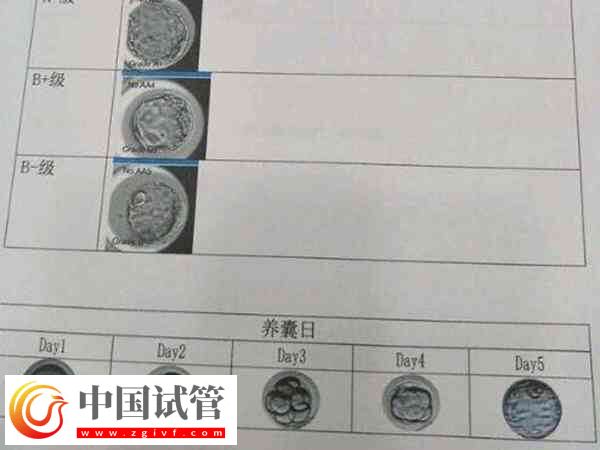 囊胚4bb和4bc移植哪个比较好(图1)
