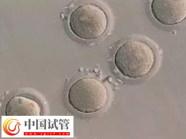 哪些情况不能移植鲜胚(图1)