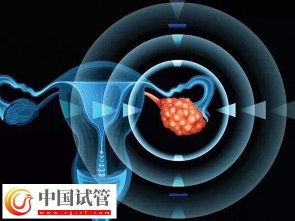 24岁卵巢早衰医生说不用治怎么回事(图1)